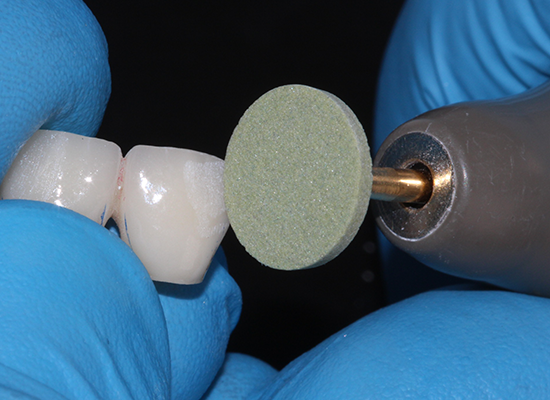 Finishing and Polishing Kits