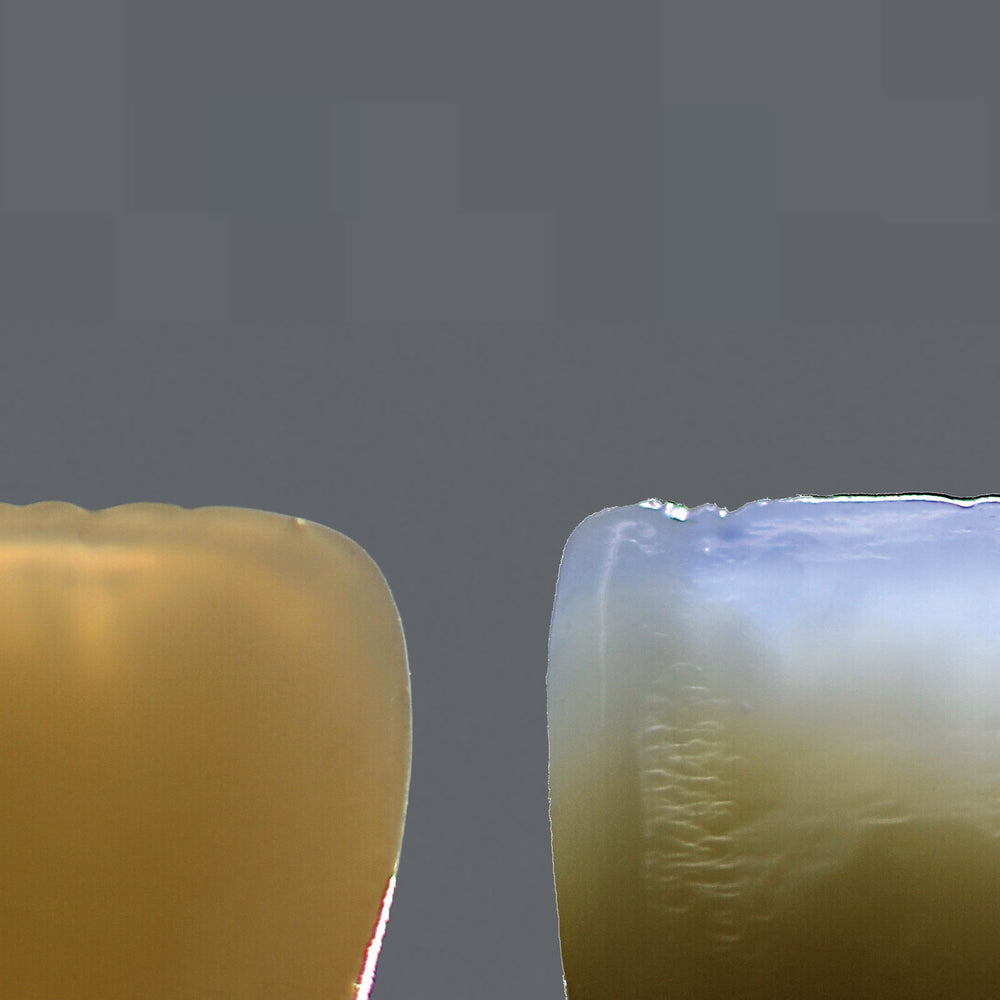 CERAMAGE UP INCISAL